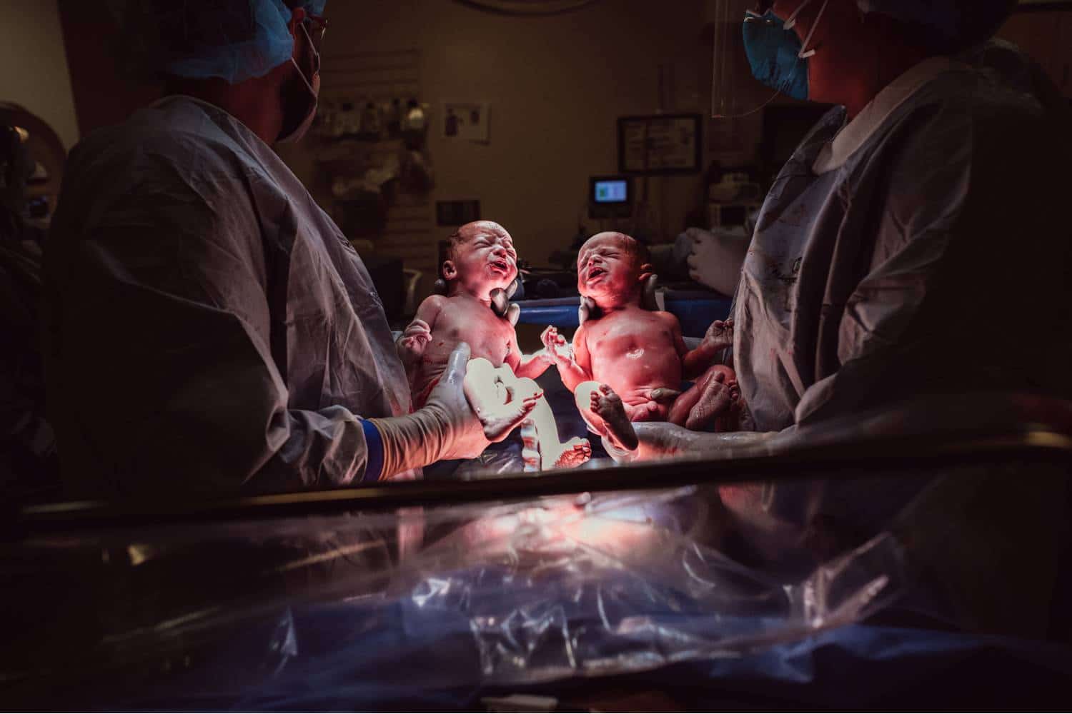 Twin newborns are held up toward the light by the physicians who delivered them.